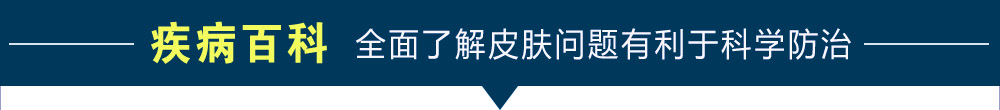 宁波治疗白癜风
